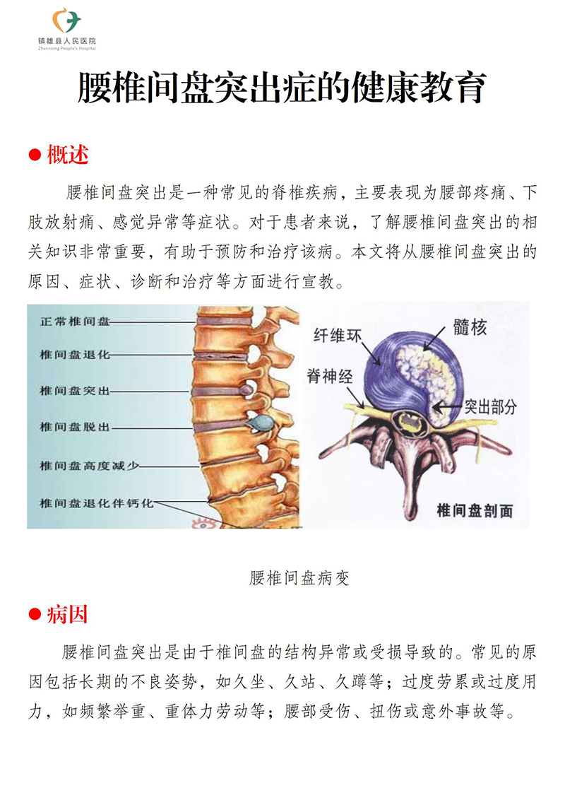腰椎间盘突出症健康教育_01.jpg