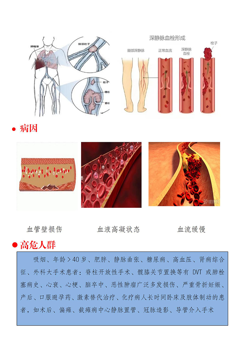 血栓的防治_02.jpg