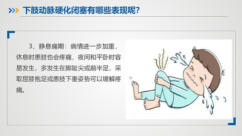 健康科普—下肢动脉硬化闭塞症_09.jpg