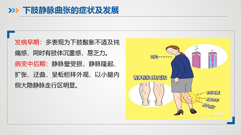 健康科普—下肢静脉曲张_08.jpg