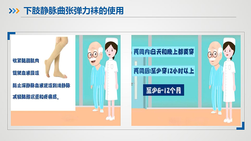 健康科普—下肢静脉曲张_14.jpg