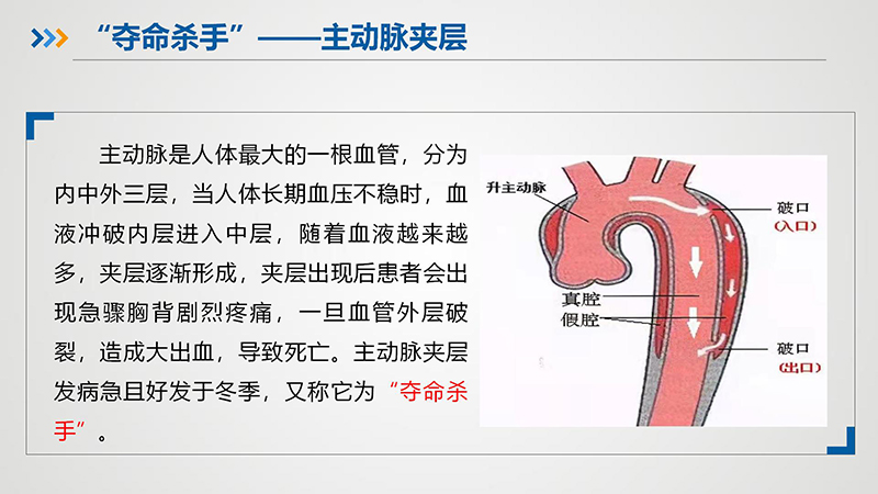 “夺命杀手”—主动脉夹层_03.jpg