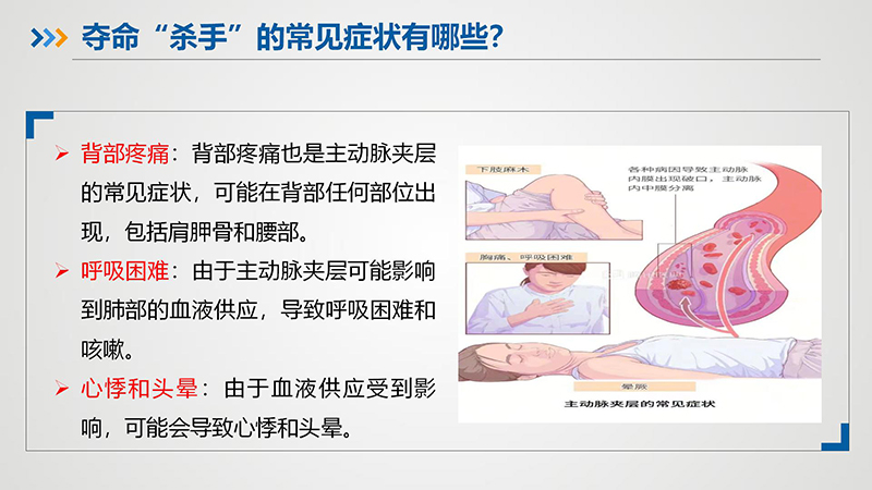 “夺命杀手”—主动脉夹层_11.jpg