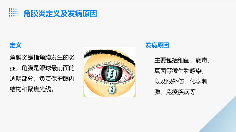 角膜炎的健康宣教ppt.pptx_04.jpg