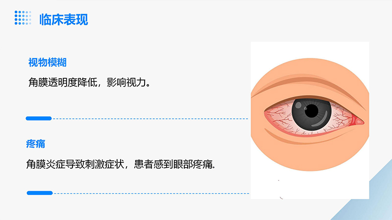 角膜炎的健康宣教ppt.pptx_05.jpg